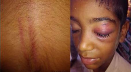 معلم إيراني يضرب طفلاً سنيًا بوحشية